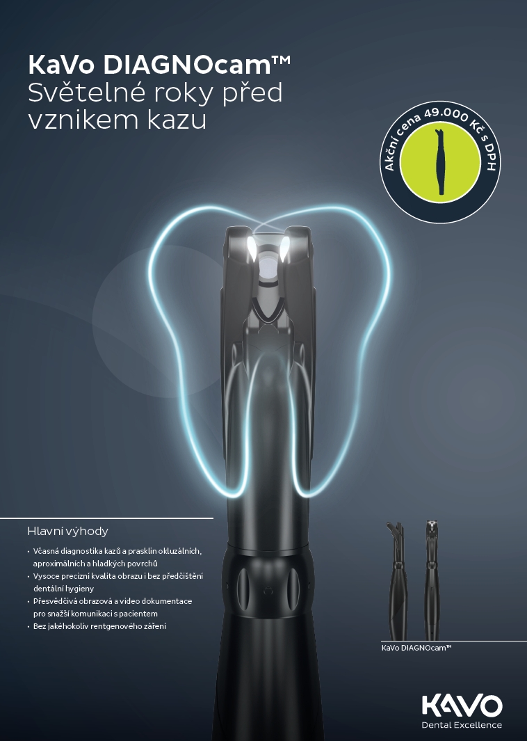 KaVo DIAGNOcam